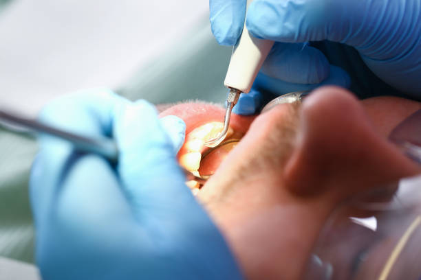 Best After-Hours Dental Trauma Care in Mountain View, CA