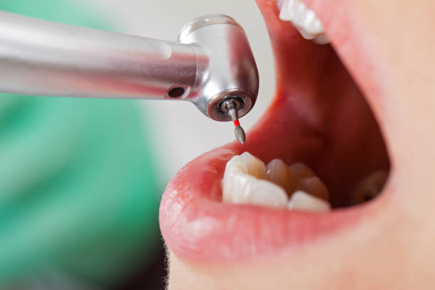 Best Emergency Denture Repair in Mountain View, CA